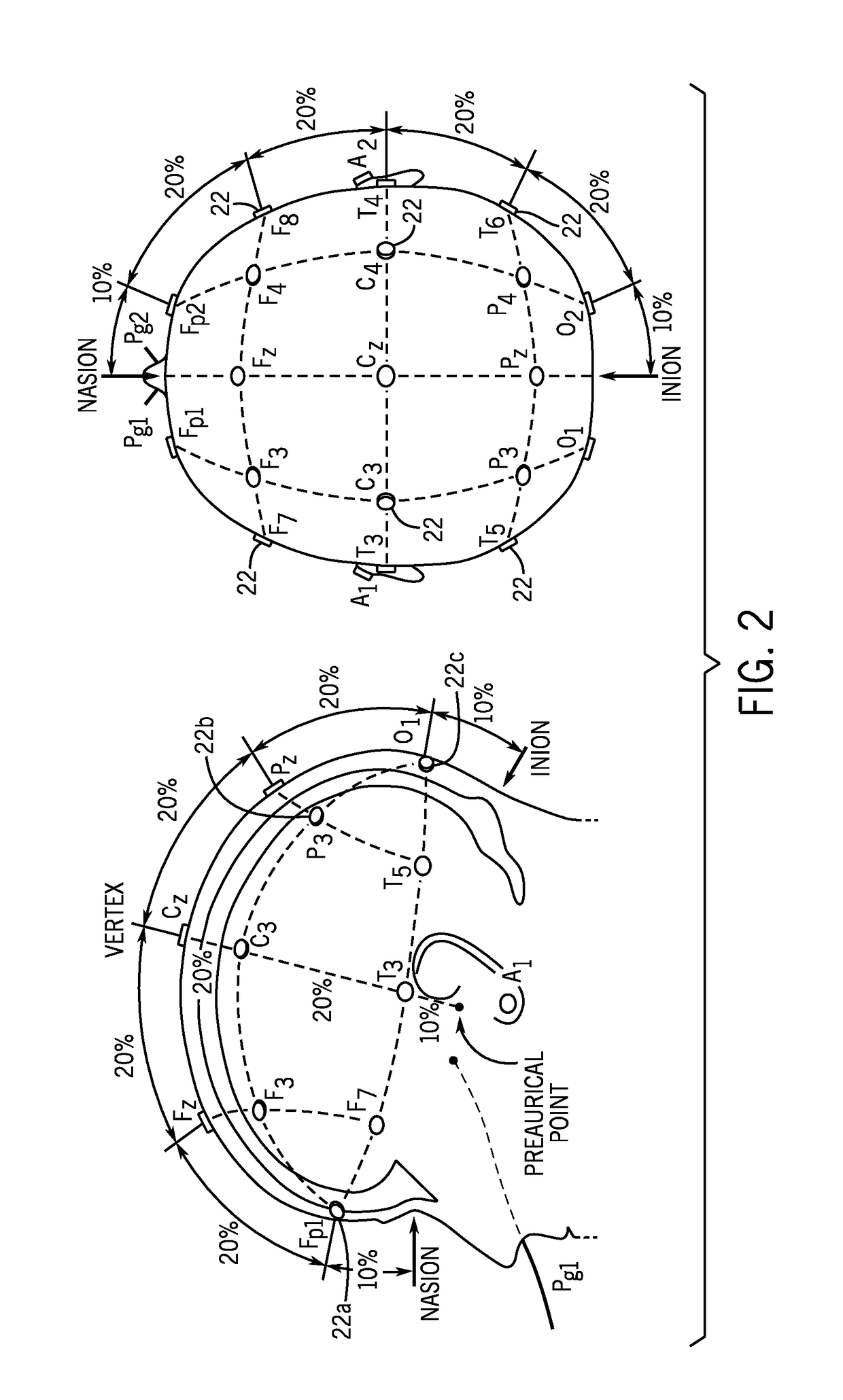 System and method for electrical impedance spectroscopy