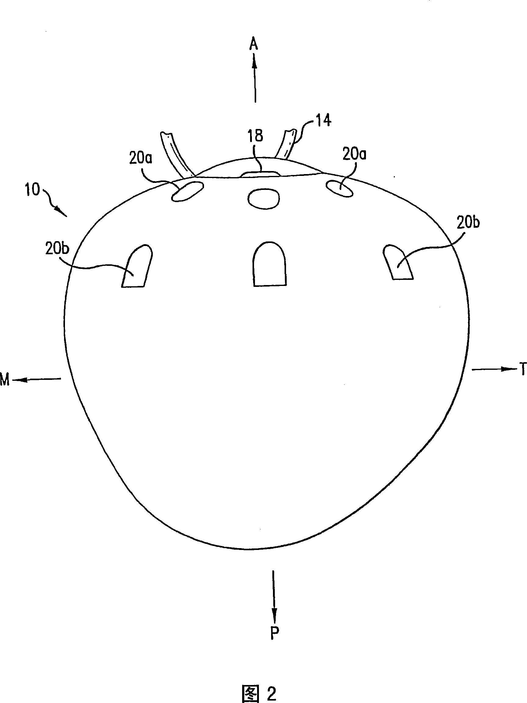 Quasi-spherical orbital implant