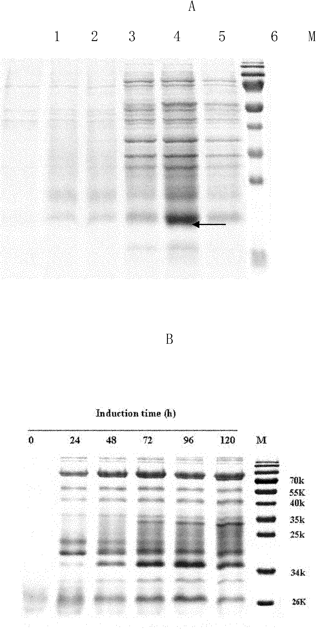 Method for expressing and purifying human recombinant interleukin-3
