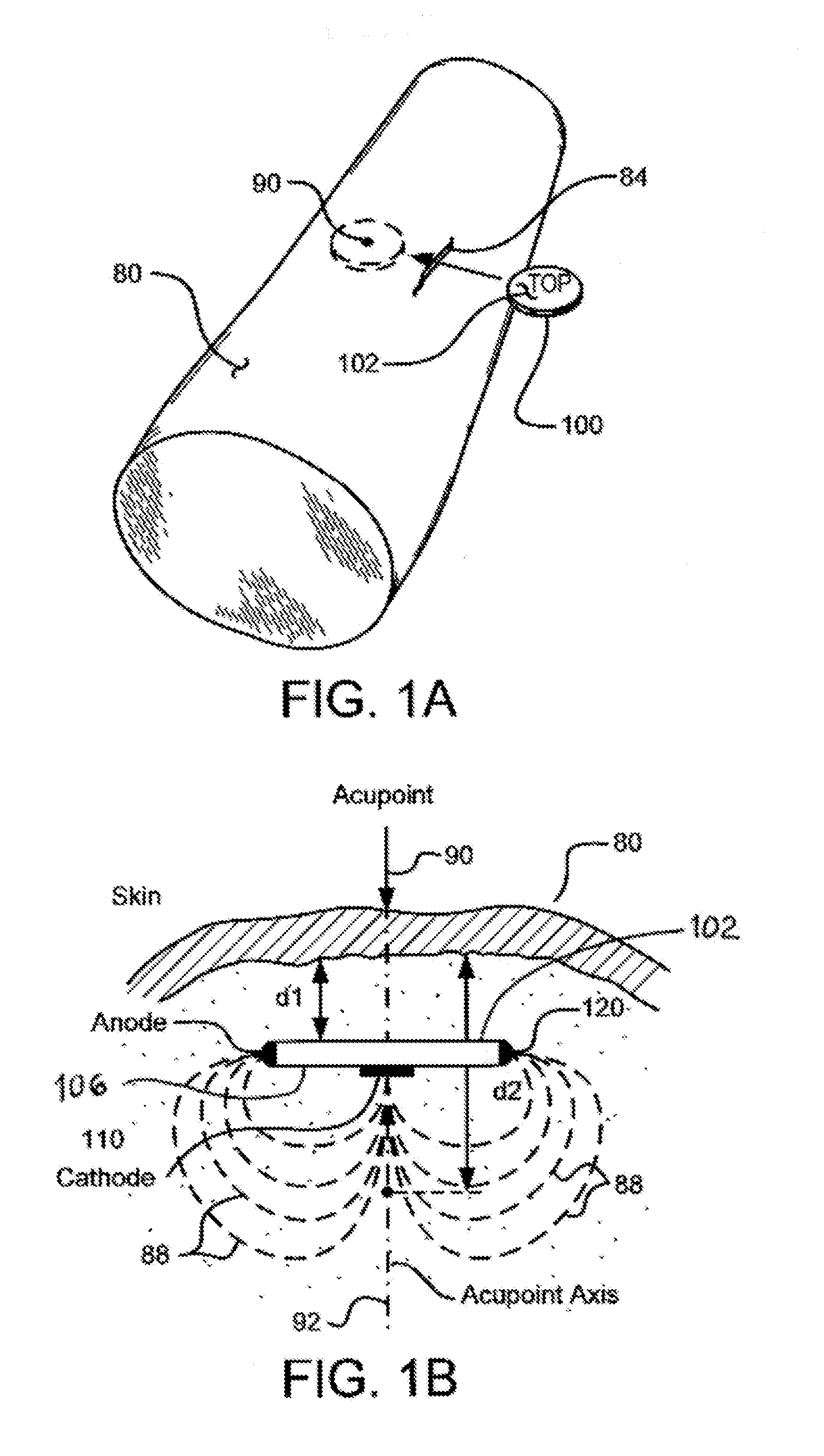 Implantable Electroacupuncture Device and Method
