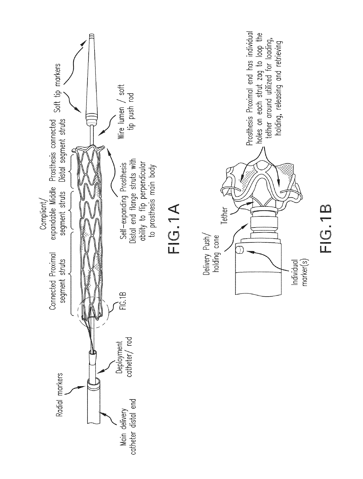 Devices and methods for effectuating percutaneous Glenn and Fontan procedures