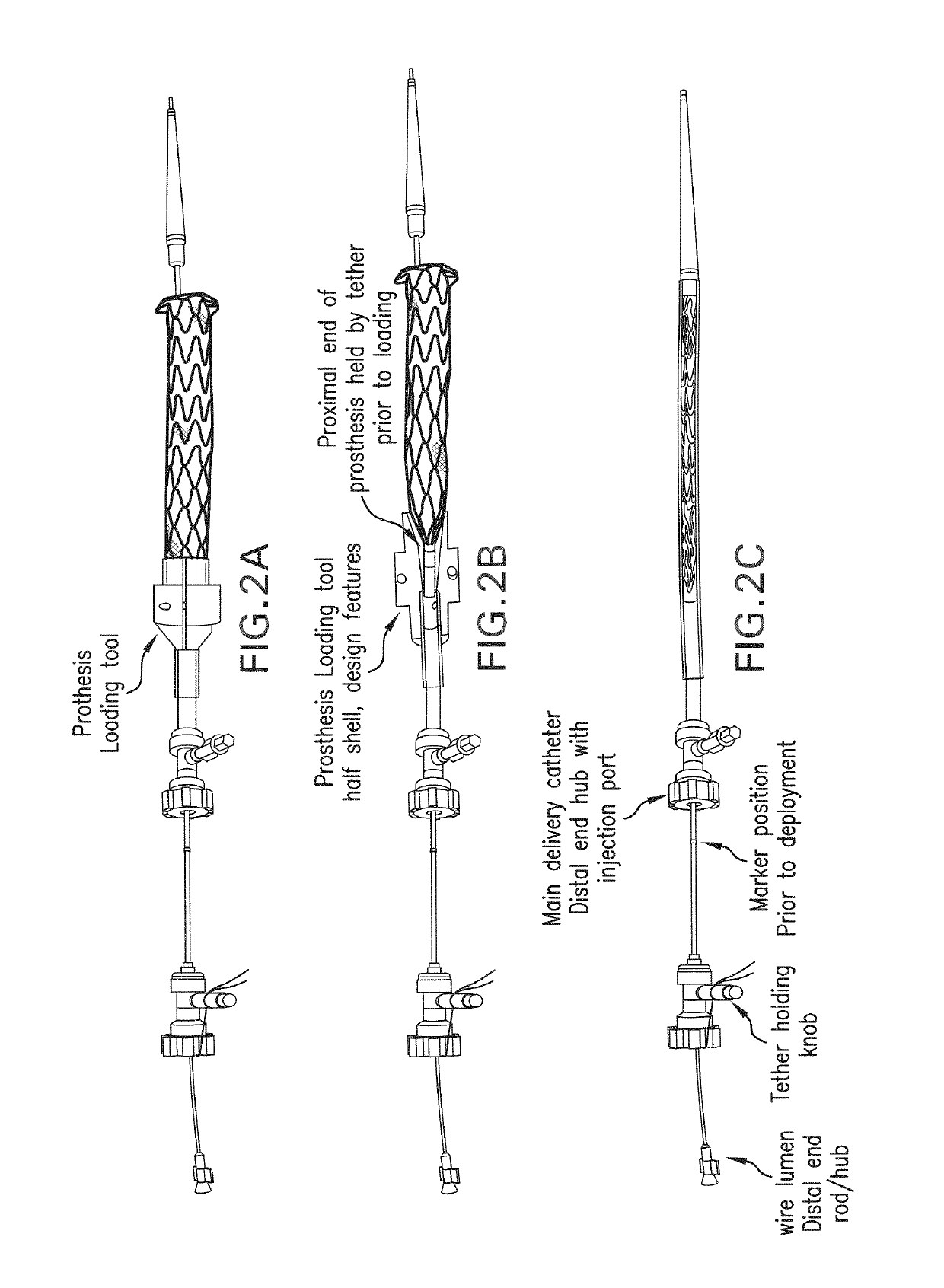 Devices and methods for effectuating percutaneous Glenn and Fontan procedures