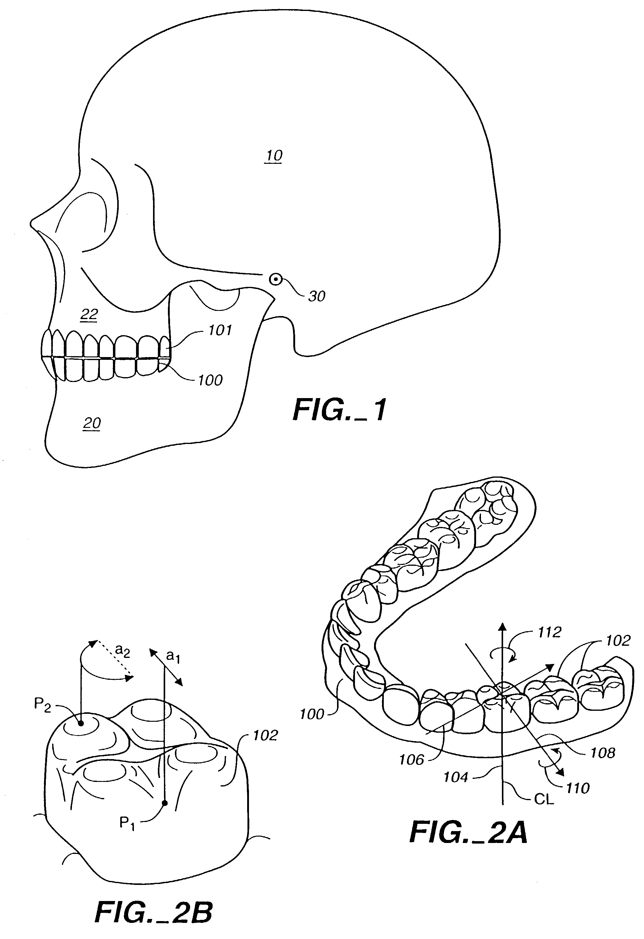 System for determining final position of teeth