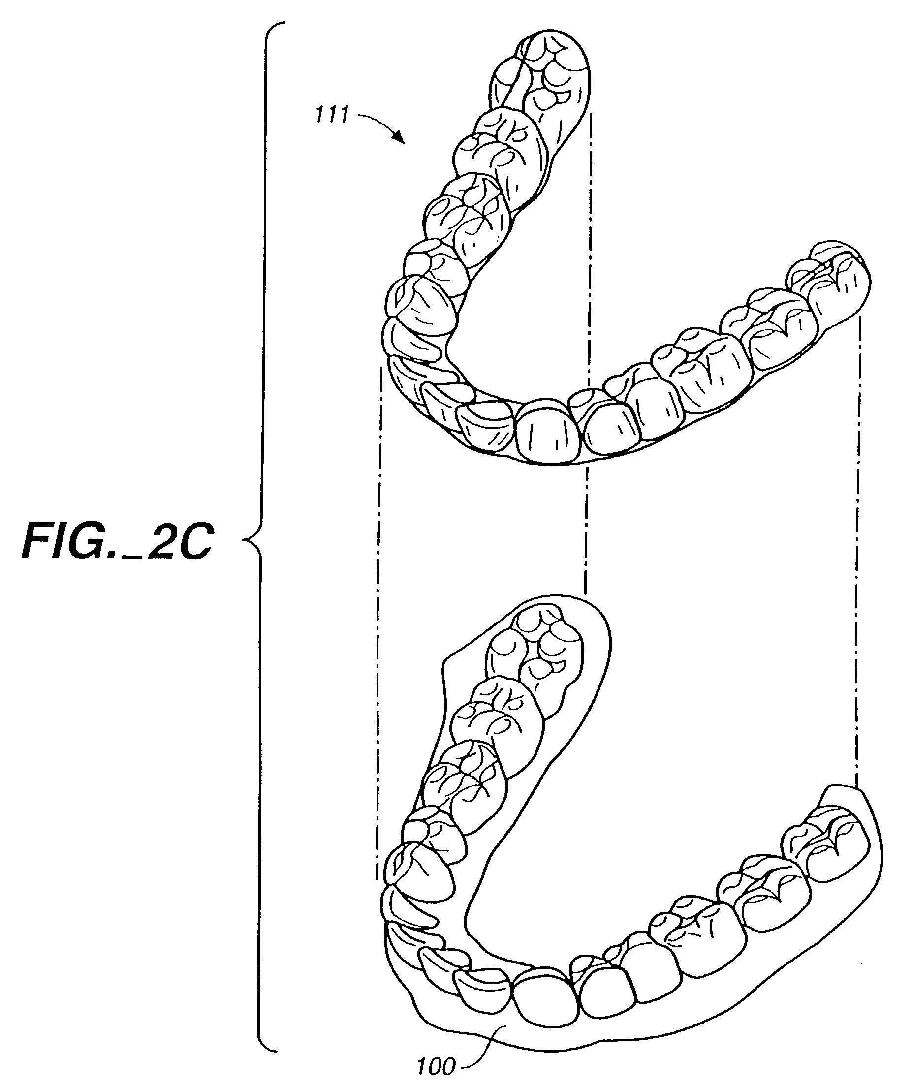 System for determining final position of teeth