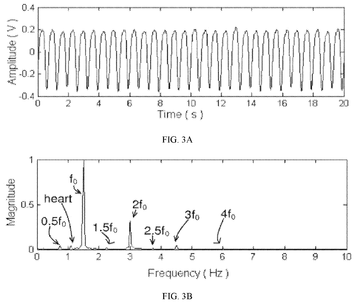 Apparatus and method for prediction of rapid symptomatic blood pressure decrease