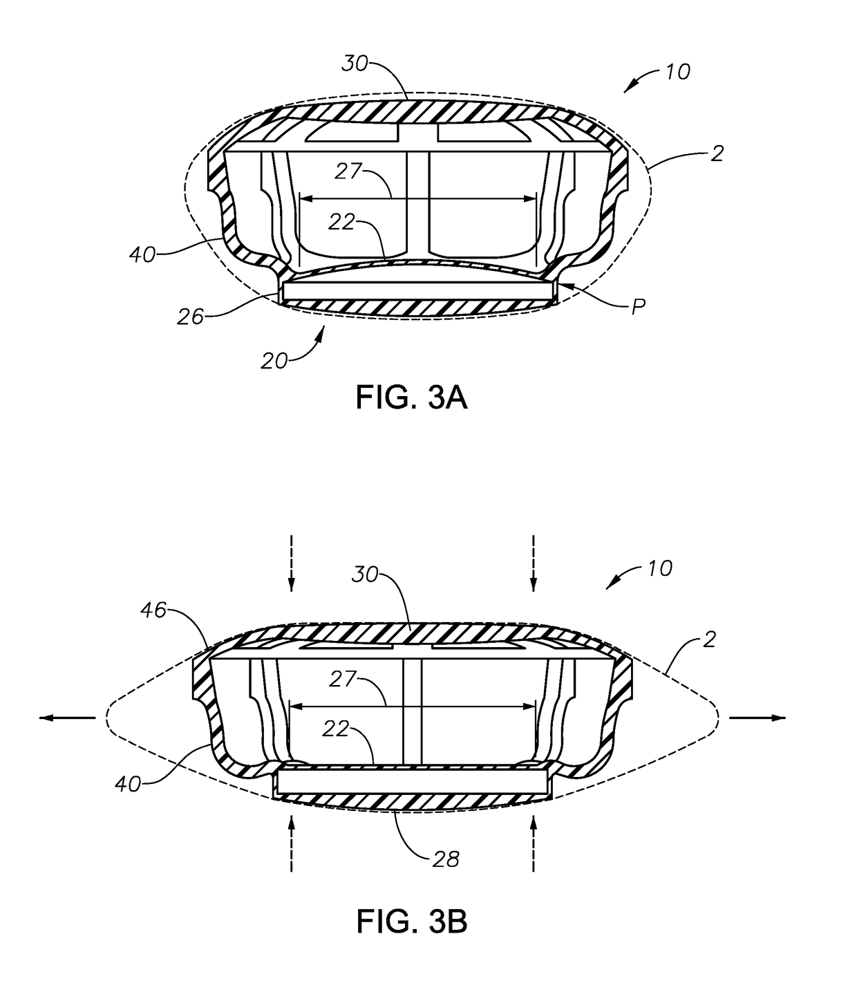 Dual optic, curvature changing accommodative iol having a fixed disaccommodated refractive state
