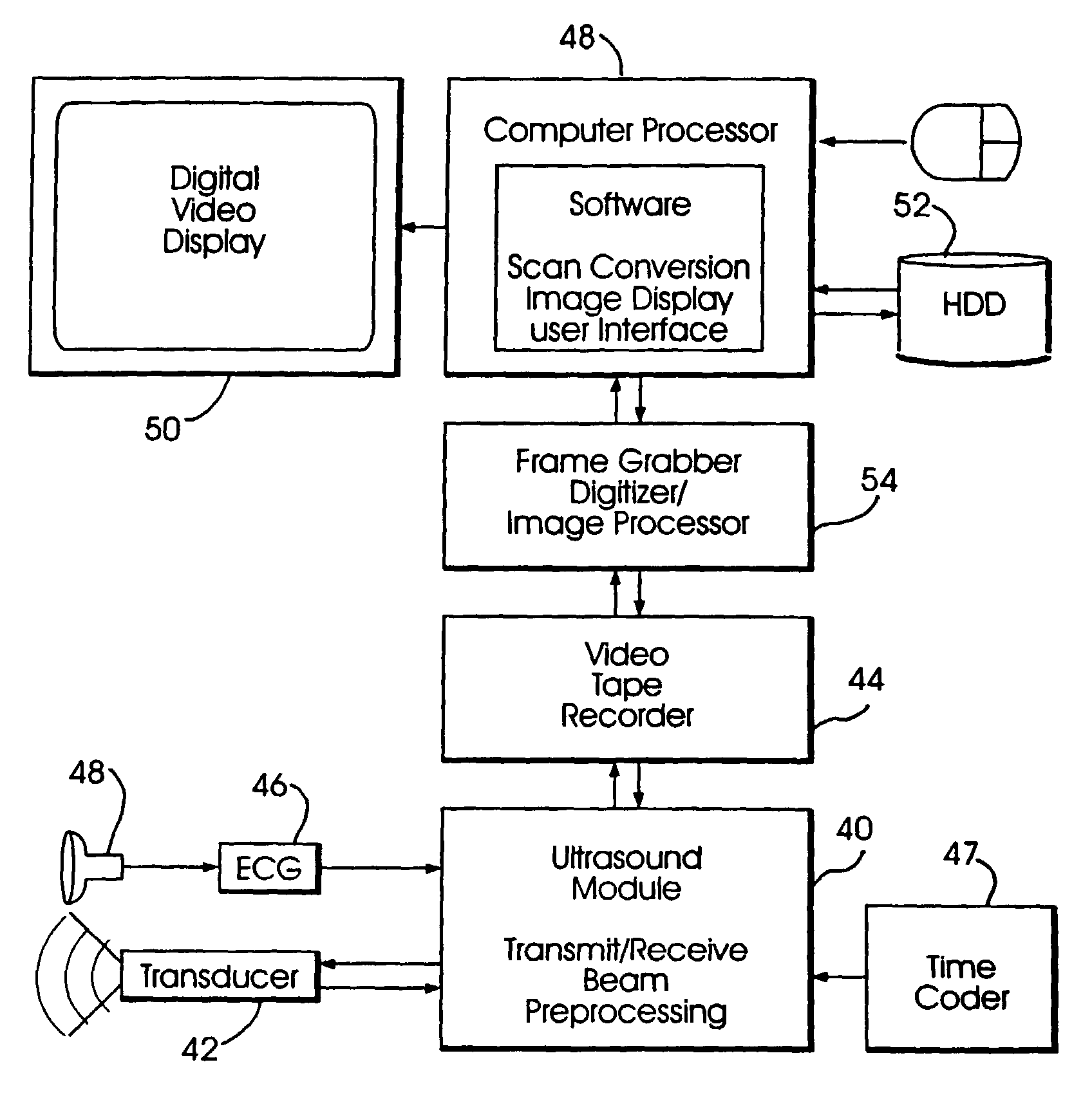 Split-screen display system and standardized methods for ultrasound image acquisition and multi-frame data processing