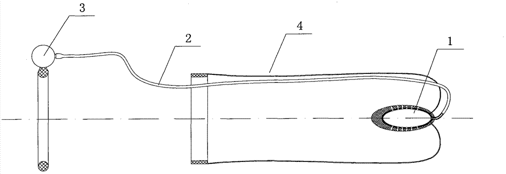 Male comfortable contraceptive suppository