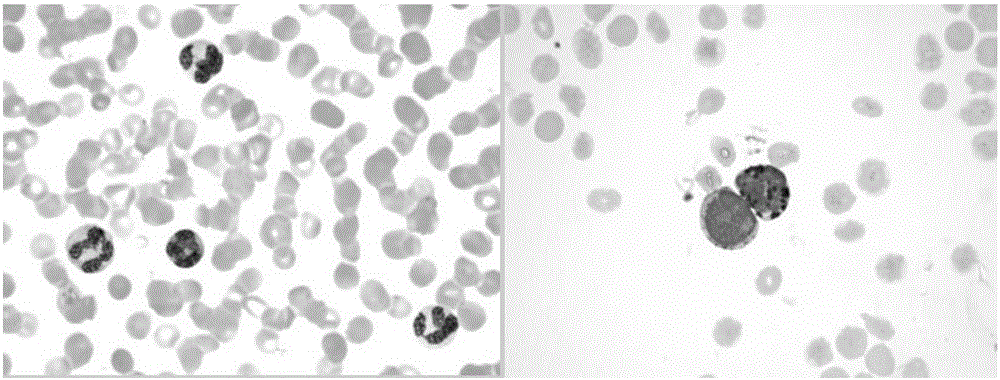 A Segmentation Method of Adhesive Leukocytes Based on Nuclear Marker Watershed Transform