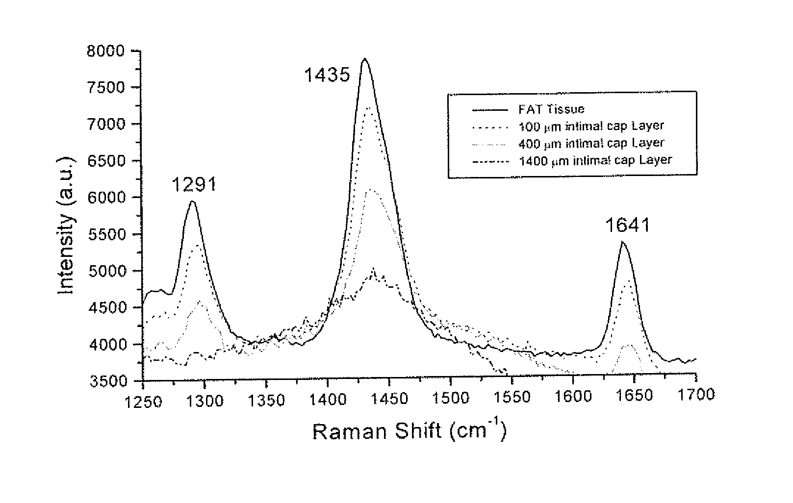 Raman and resonant raman detection of vulnerable plaque optical analyzer and imager