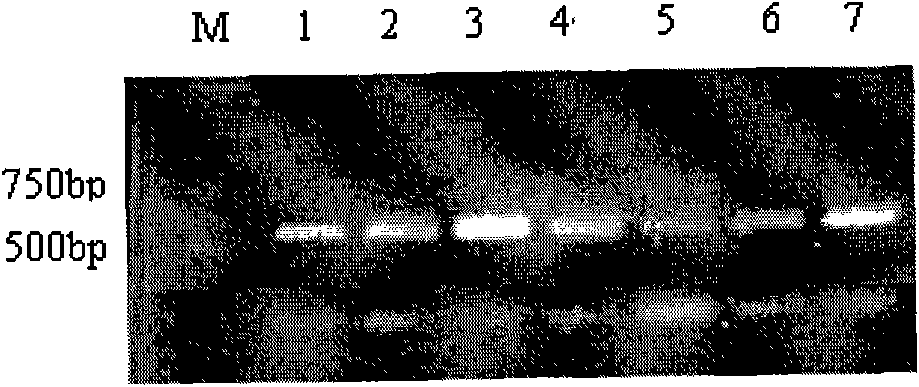 Improved gene construction method and property testing of fast-acting insulin precursor