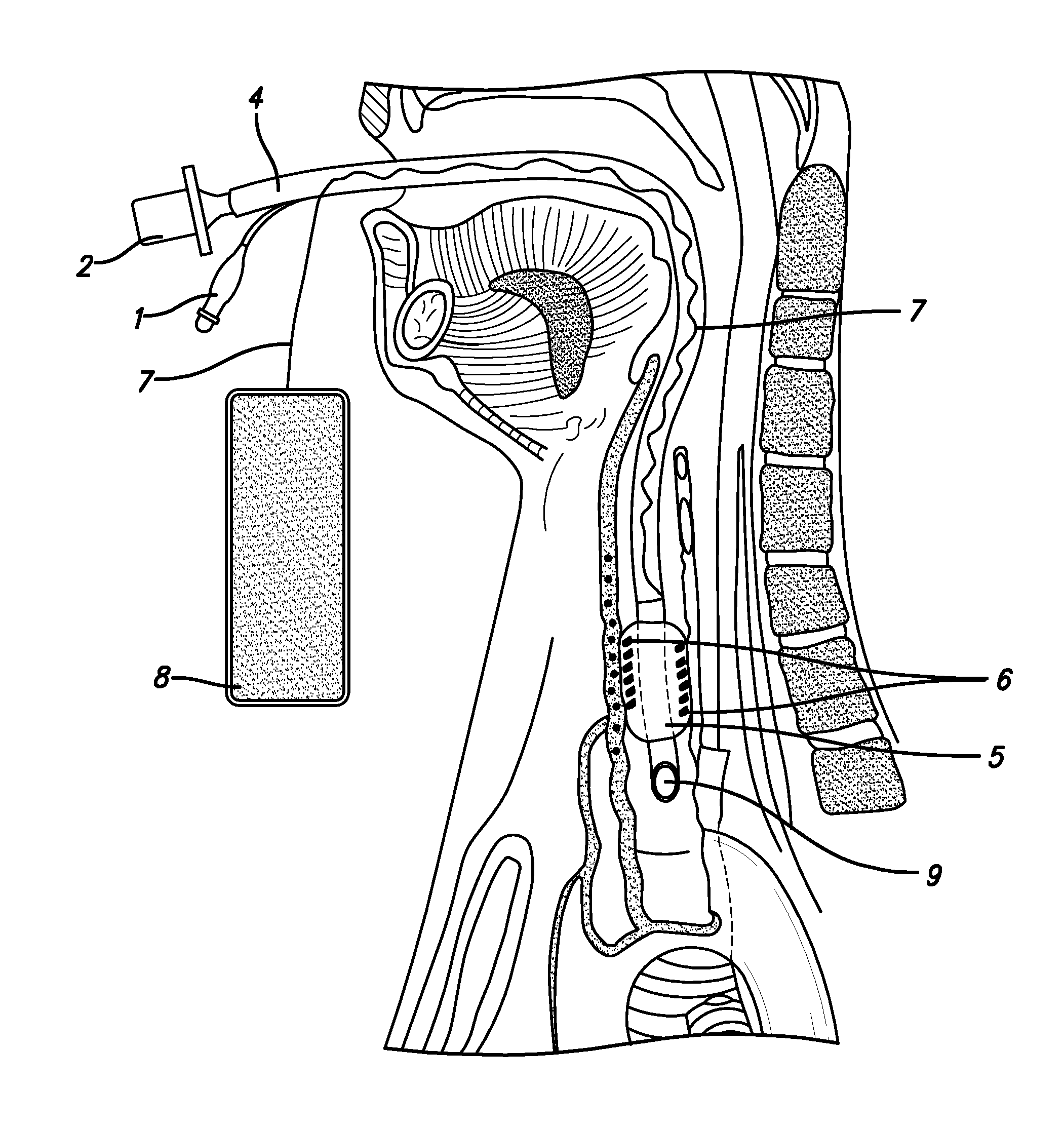 System and method for imaging endotracheal tube placement and measuring airway occlusion cuff pressure