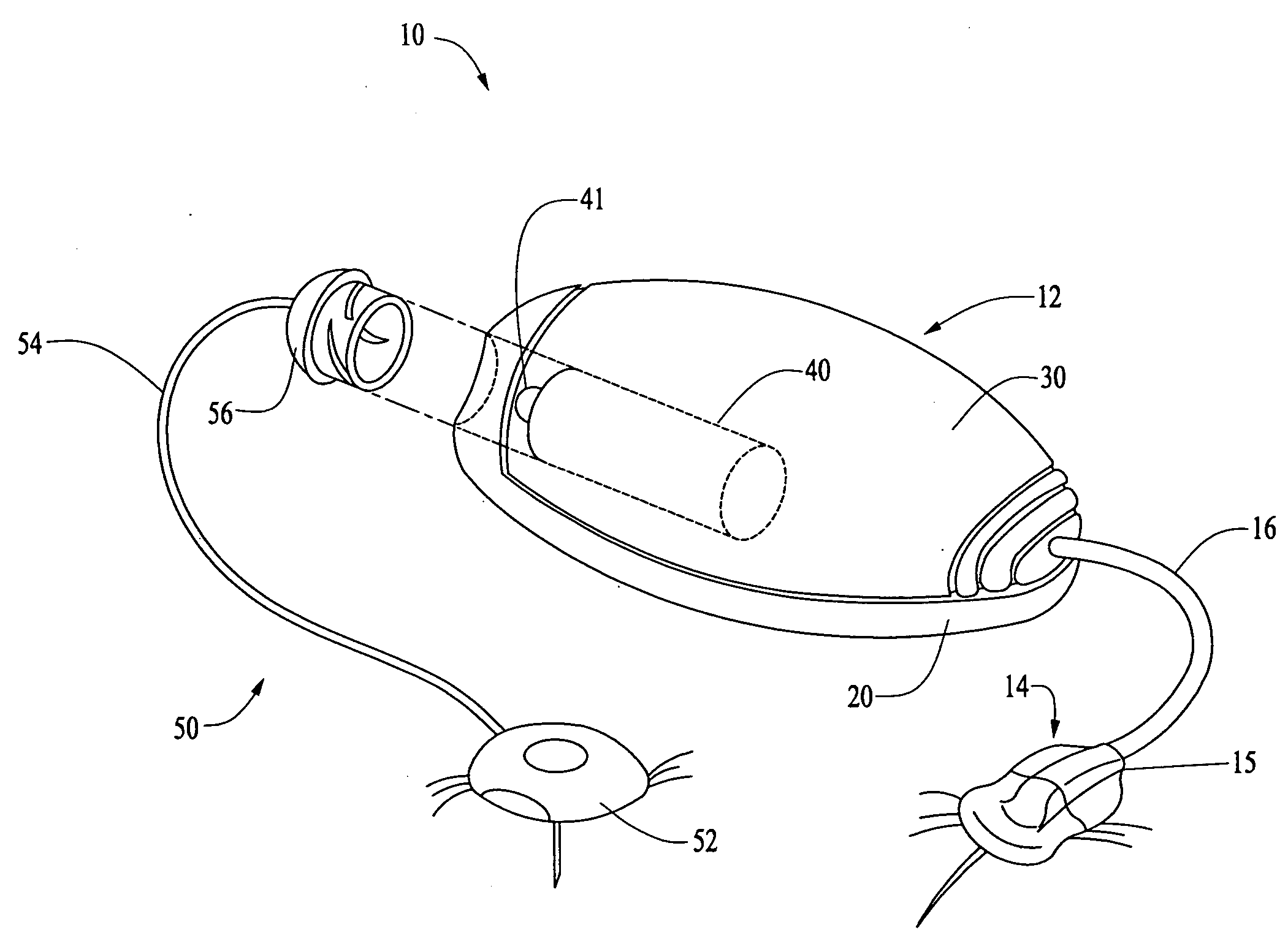 Needle insertion systems and methods