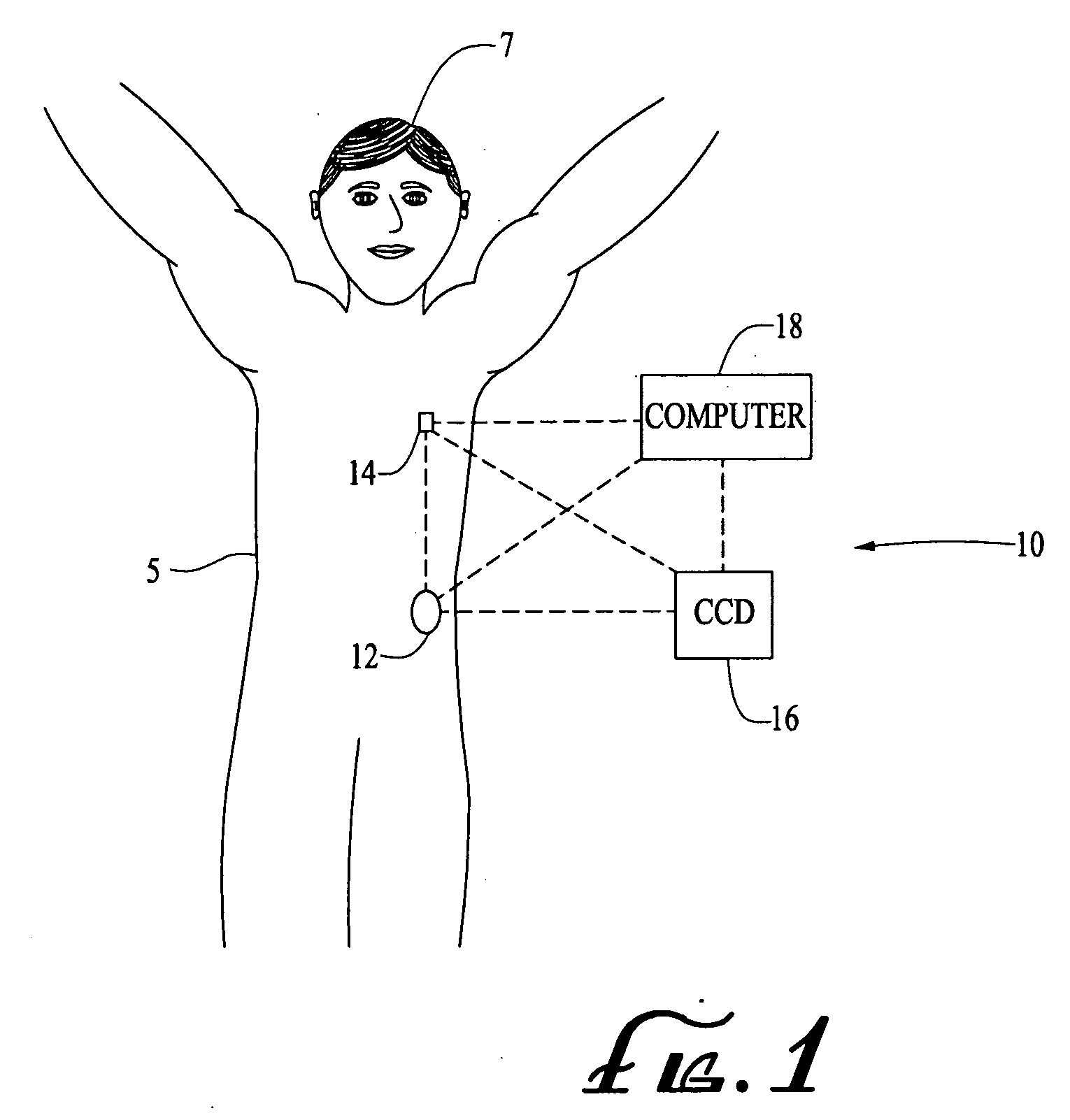 Needle insertion systems and methods