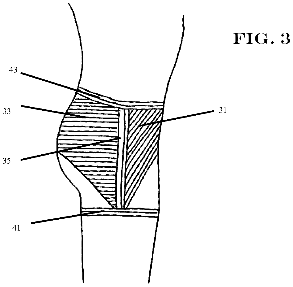 Gird compression hip tensioning garment