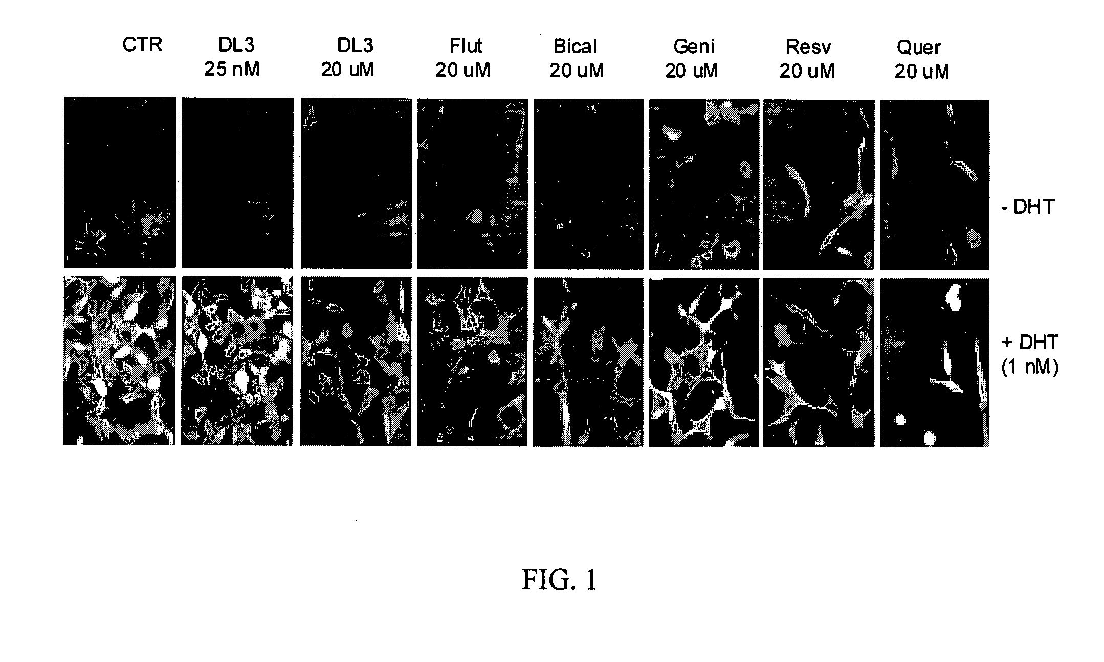 Methods for treating androgen receptor related disorders