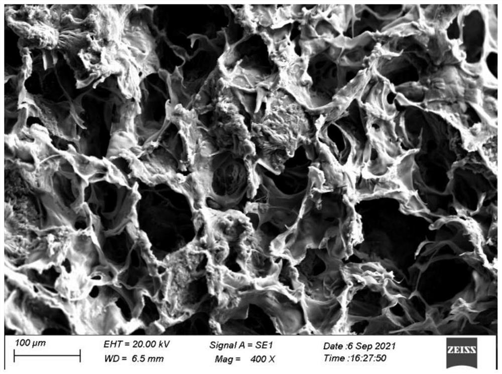A kind of thermosensitive gel material combination and its preparation method and application
