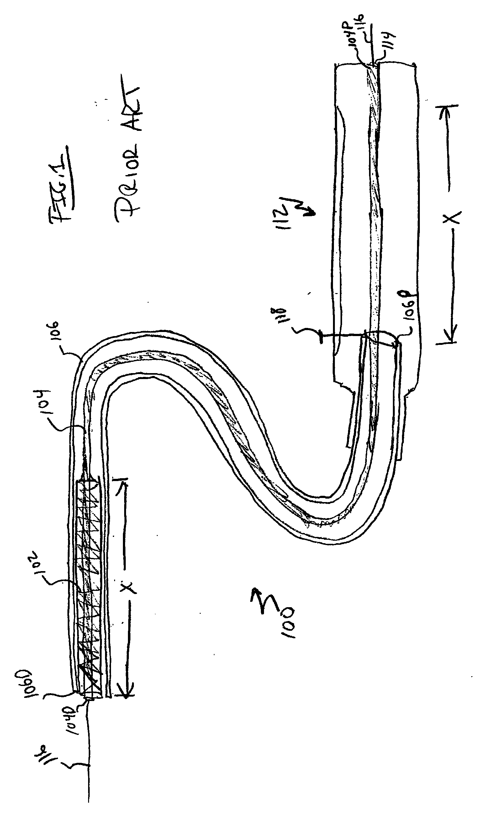 Short Handle for a Long Stent