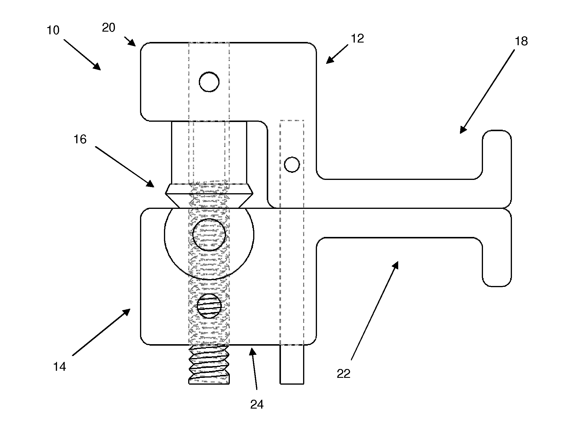 Spinal decompression system and method