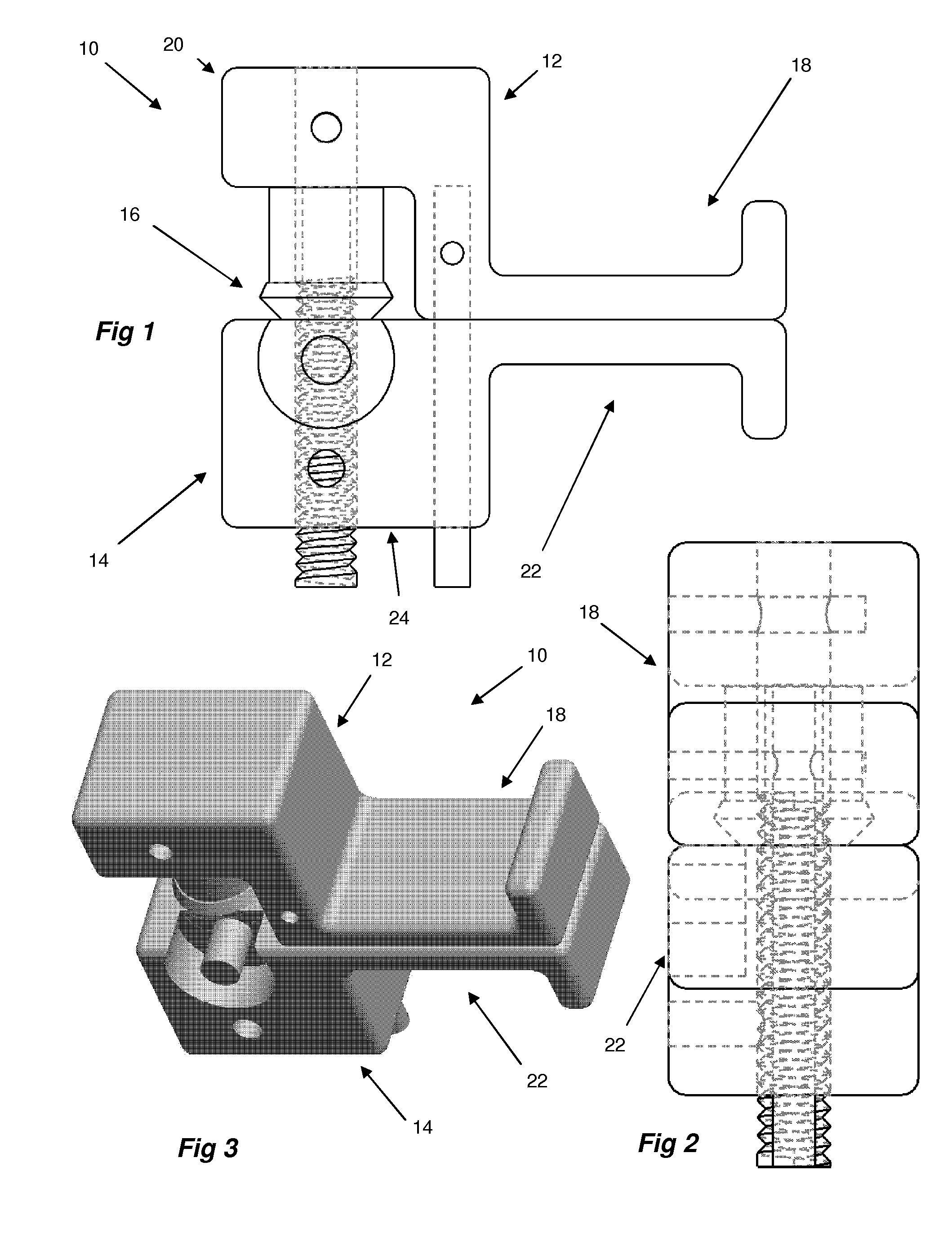 Spinal decompression system and method