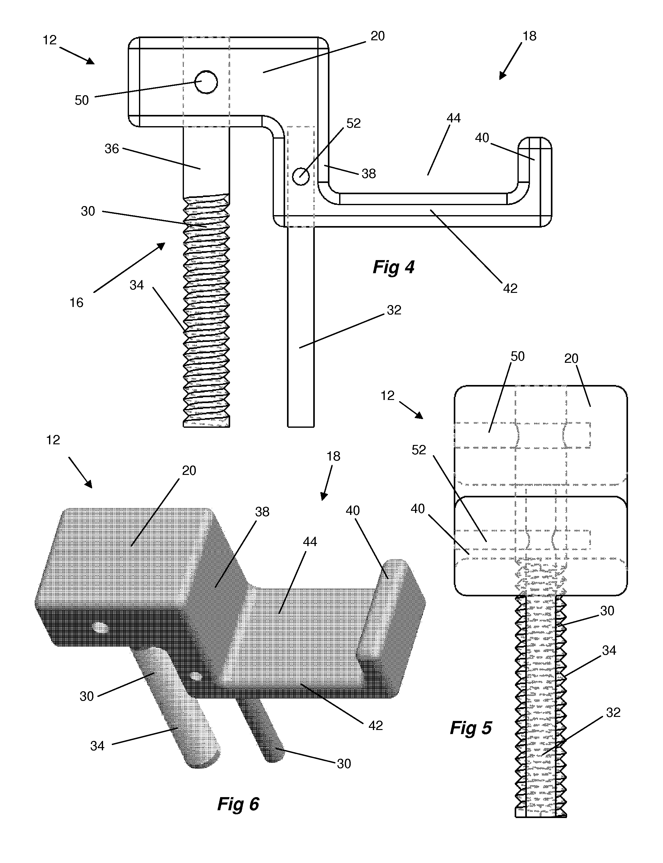 Spinal decompression system and method