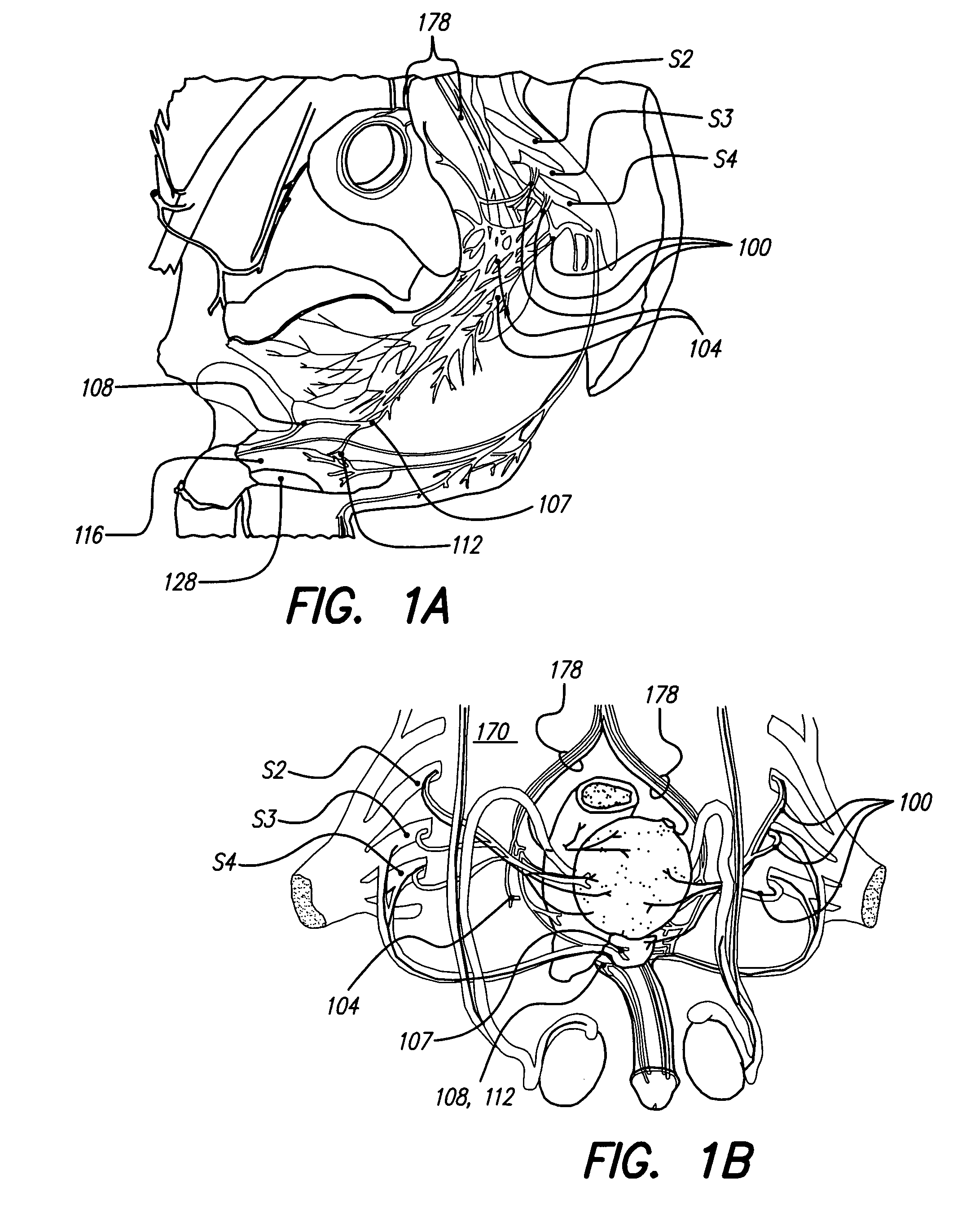 Methods and systems for electrical and/or drug stimulation as a therapy for erectile dysfunction
