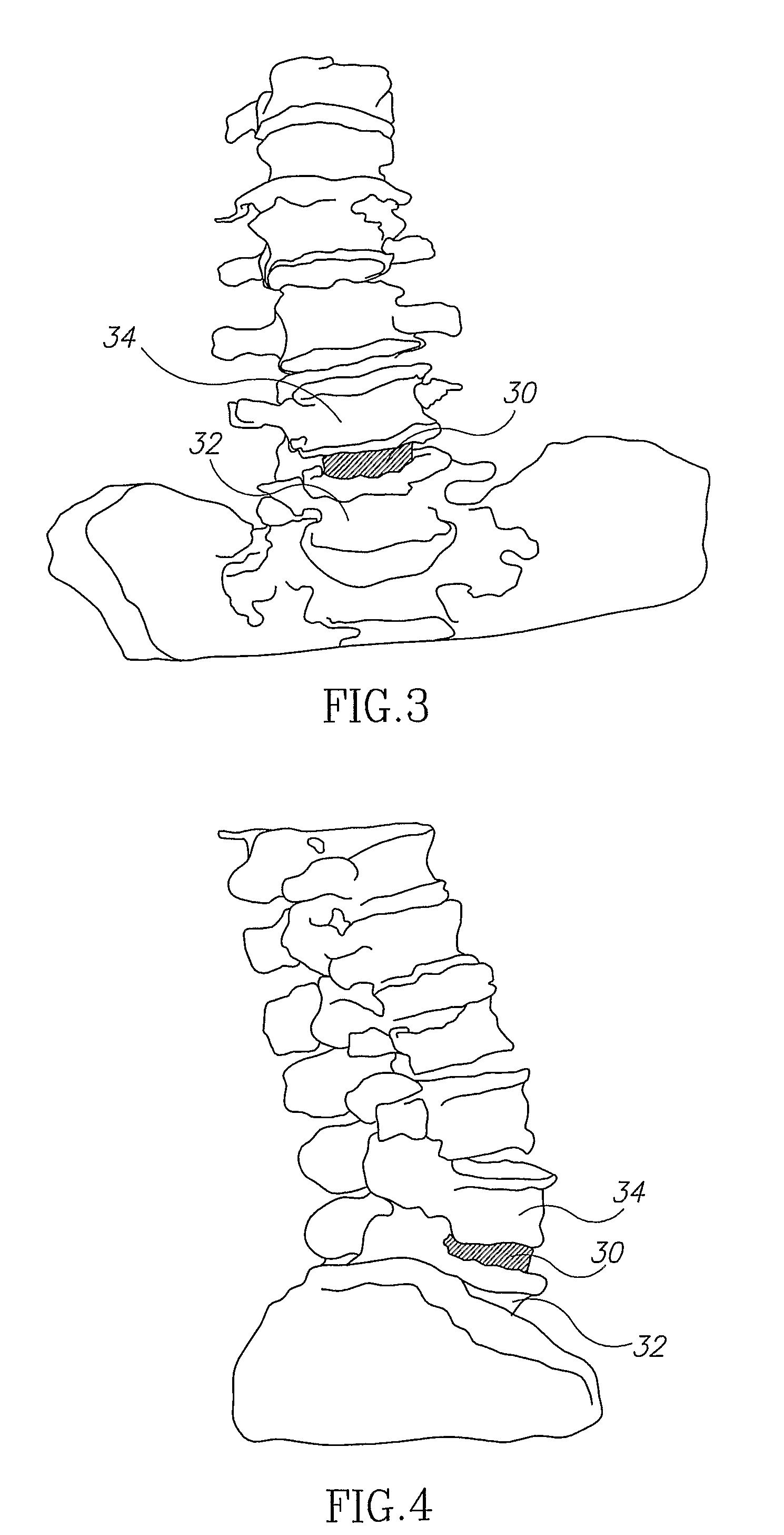 System for positioning of surgical inserts and tools
