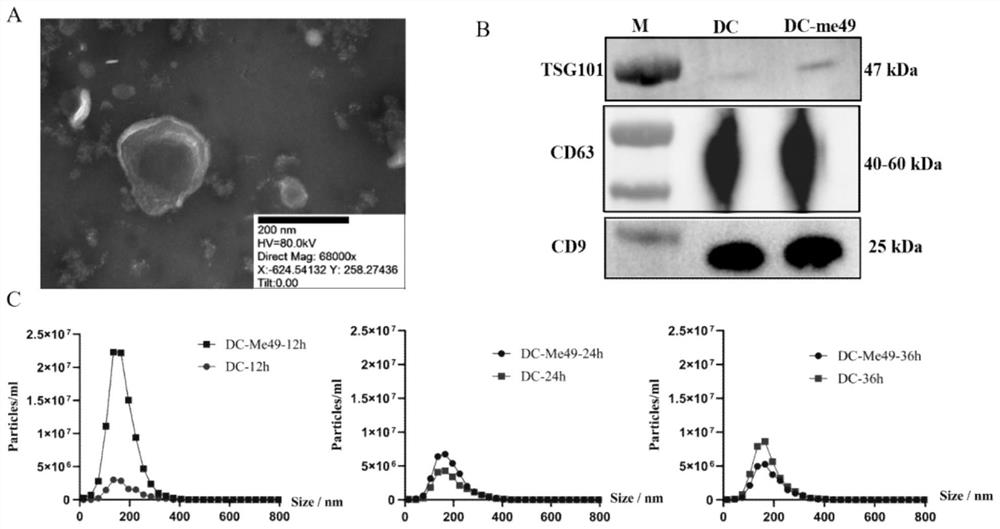 Preparation and application of exosome of toxoplasma gondii infected DC