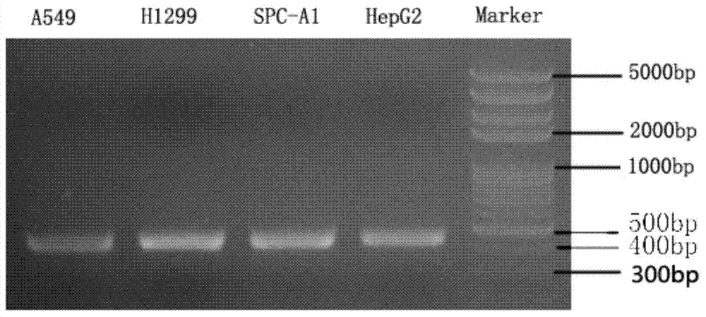 Sdr5-fc fusion protein and uses thereof