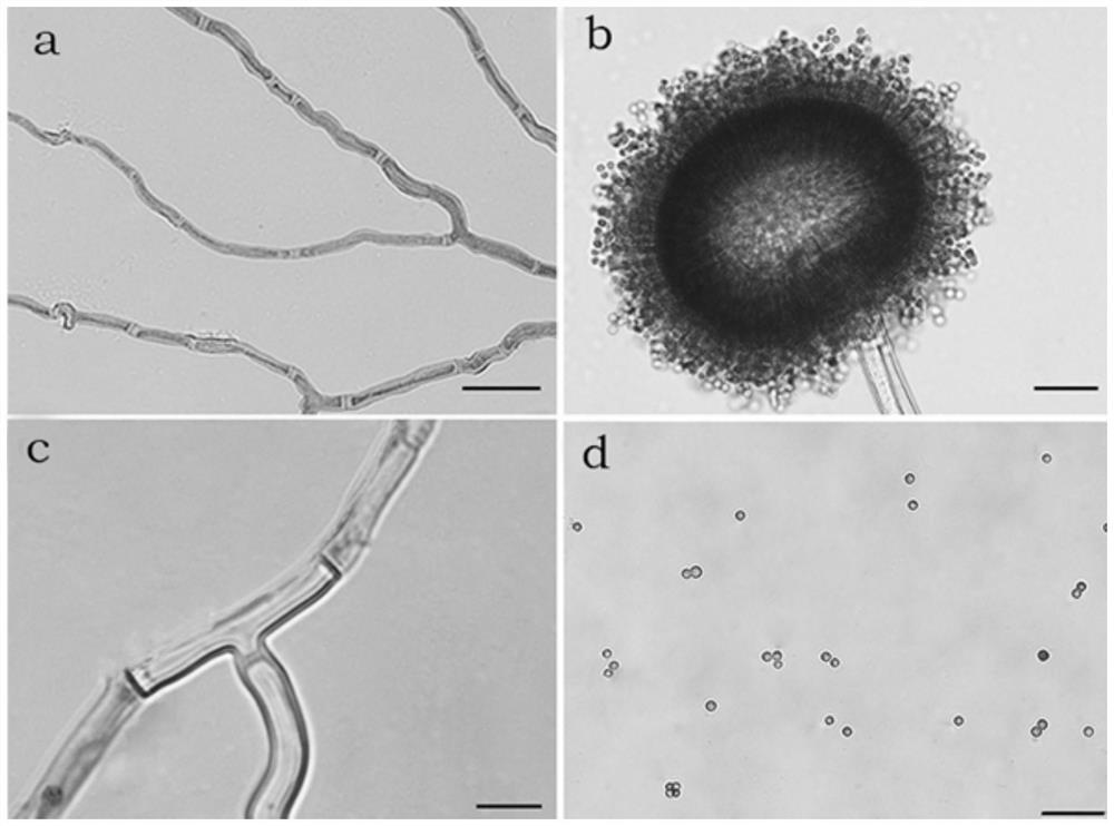 Preparation and application of a strain of Aspergillus niger that decomposes phosphorus, potassium and cellulose and its bacterial agent