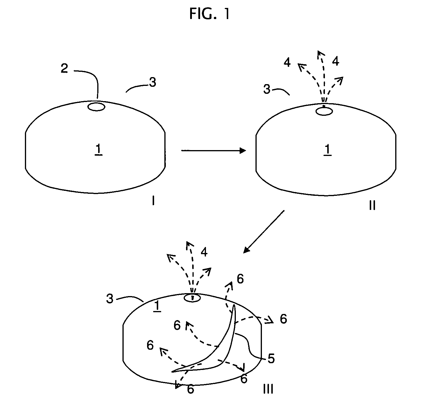 Rupturing controlled release device comprising a subcoat