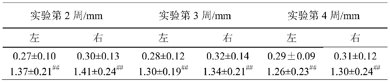 Traditional Chinese medicine composition for treating osteoarthritis and preparation method and application of traditional Chinese medicine composition
