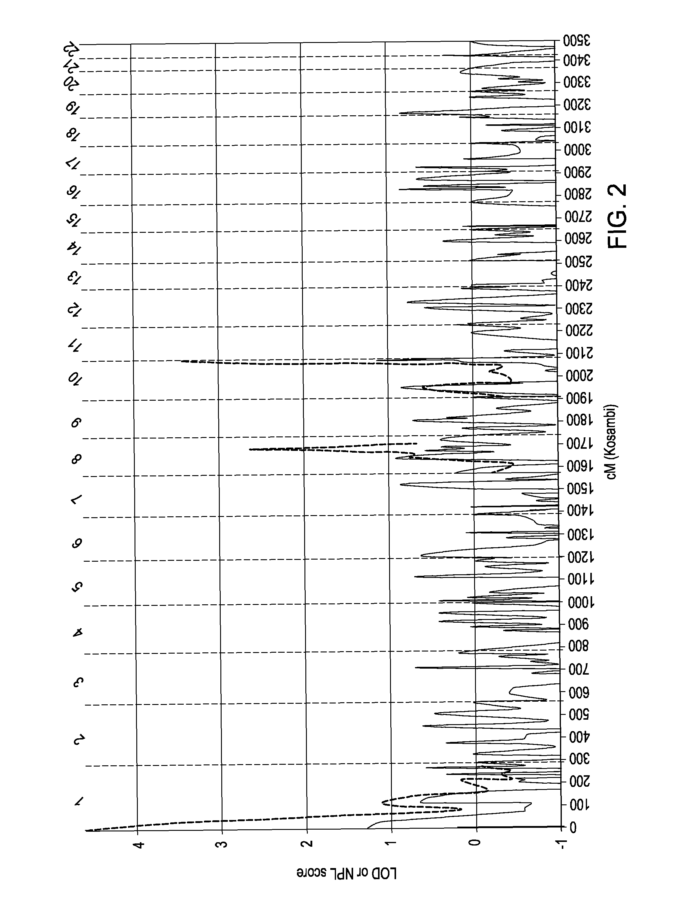 <i>CHD7 </i>gene polymorphisms are associated with susceptibility to idiopathic scoliosis