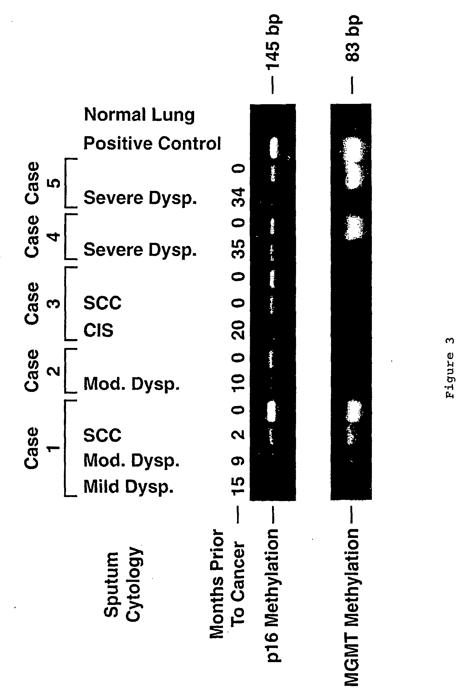 Nested methylation-specific polymerase chain reaction cancer detection method