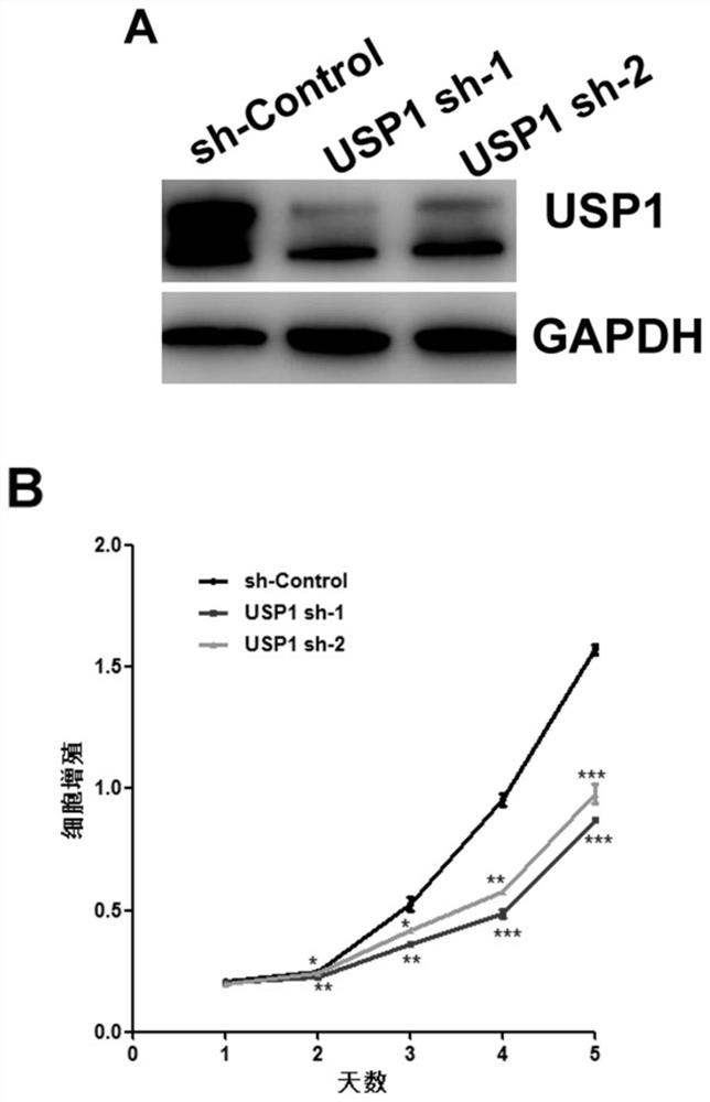 Application of substance for reducing USP1 expression in preparation of medicine for treating children T-series acute lymphoblastic leukemia