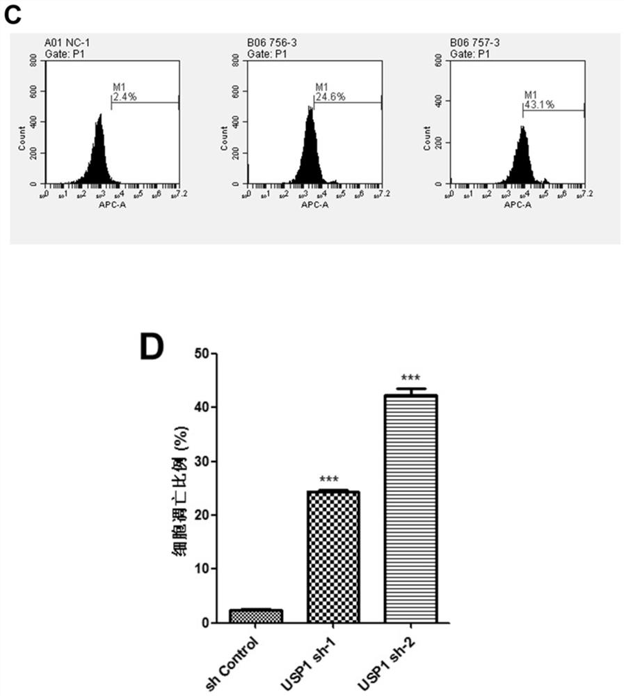 Application of substance for reducing USP1 expression in preparation of medicine for treating children T-series acute lymphoblastic leukemia