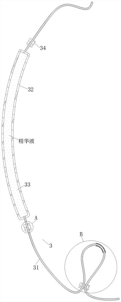 Acne-removing and freckle-removing essence mask and preparation method thereof