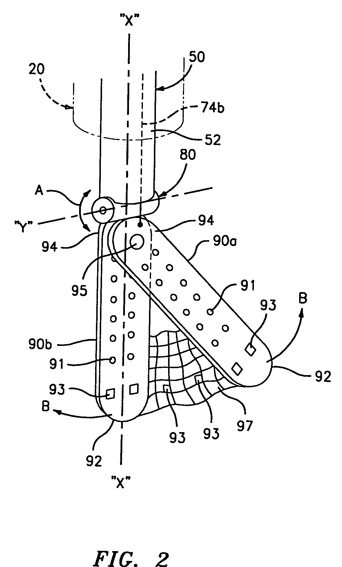 Endoscopic organ retractor and method of using the same