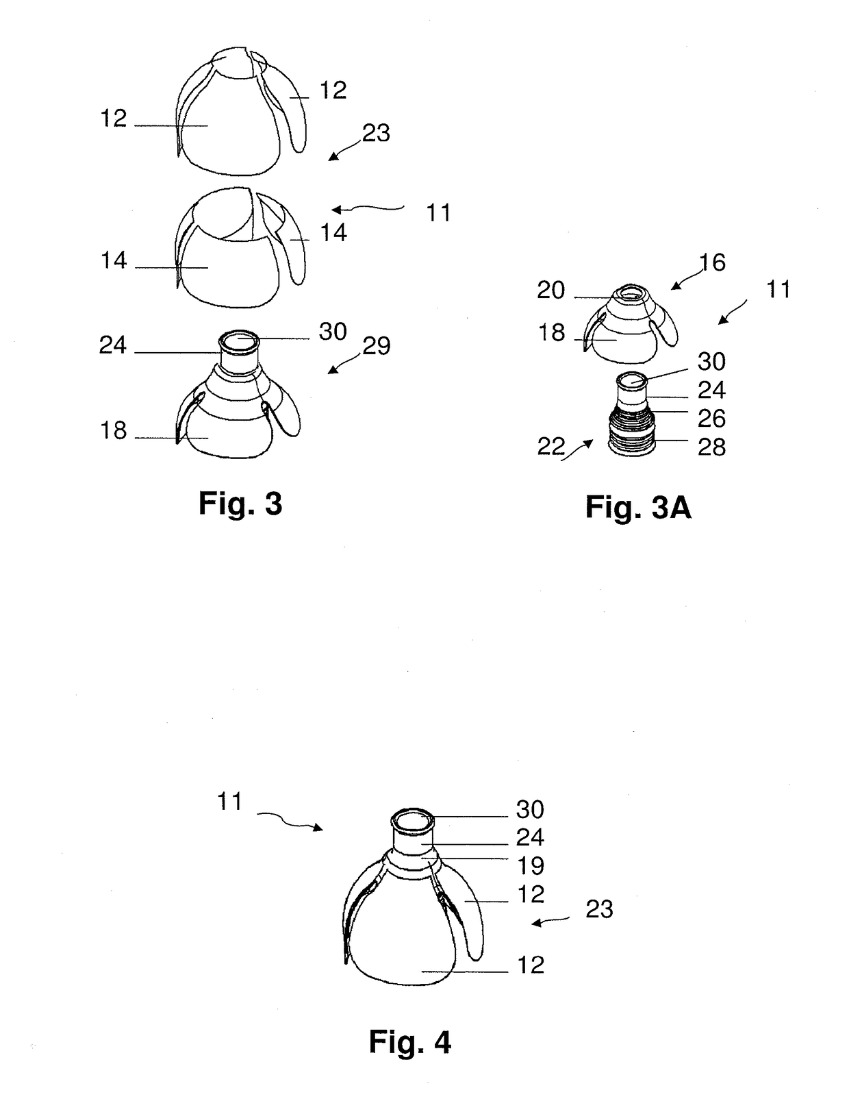 Device and method for external urinary incontinence treatment for men