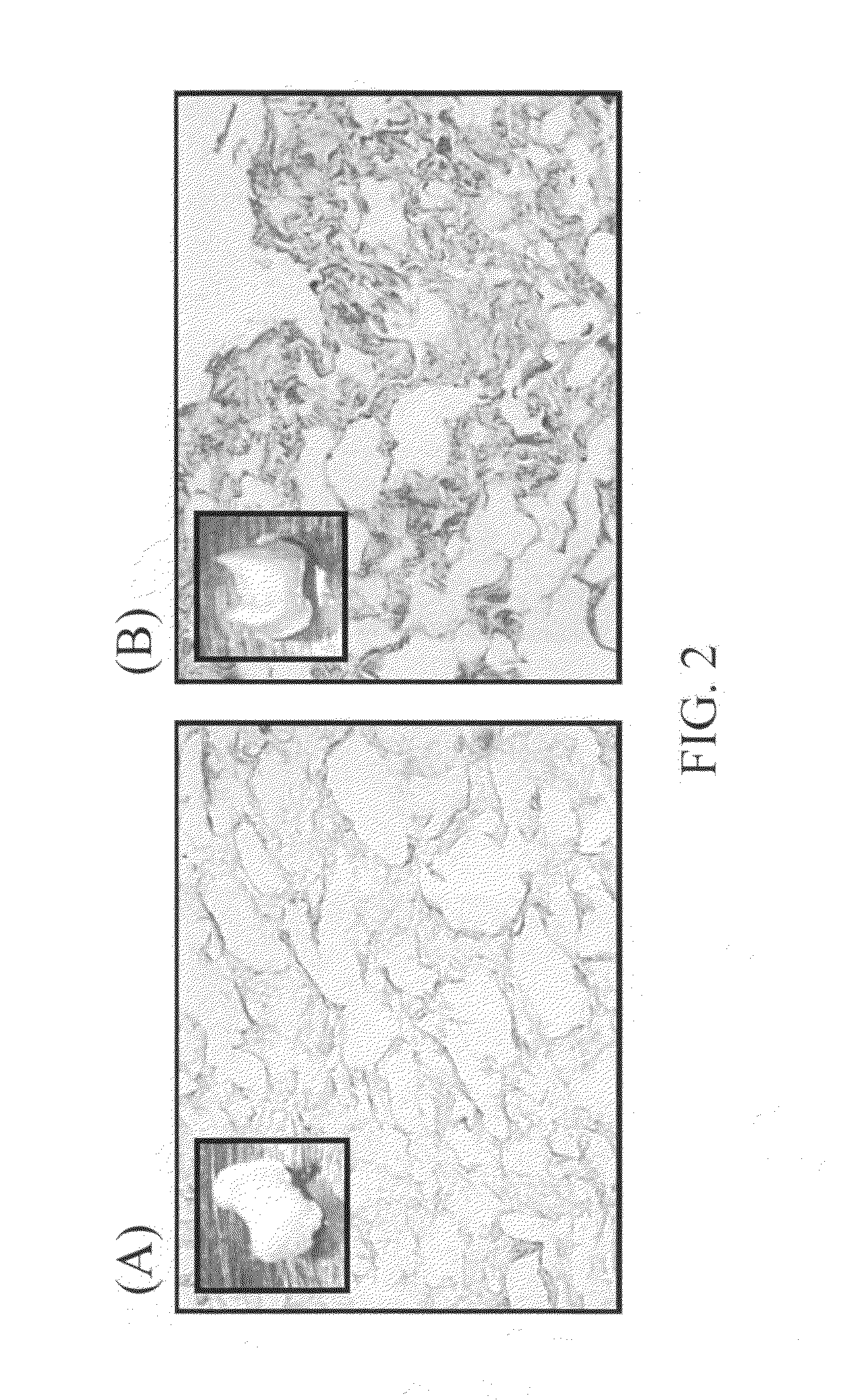 Bone implant and manufacturing method thereof