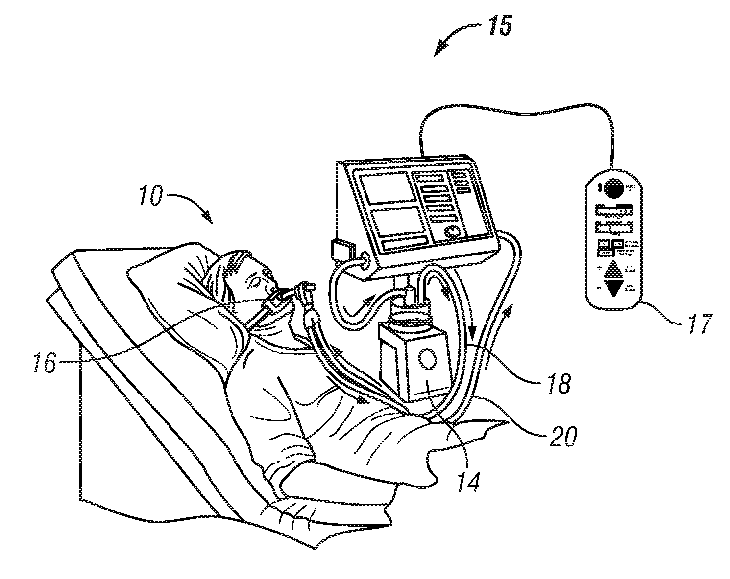 Patient-controlled ventilation