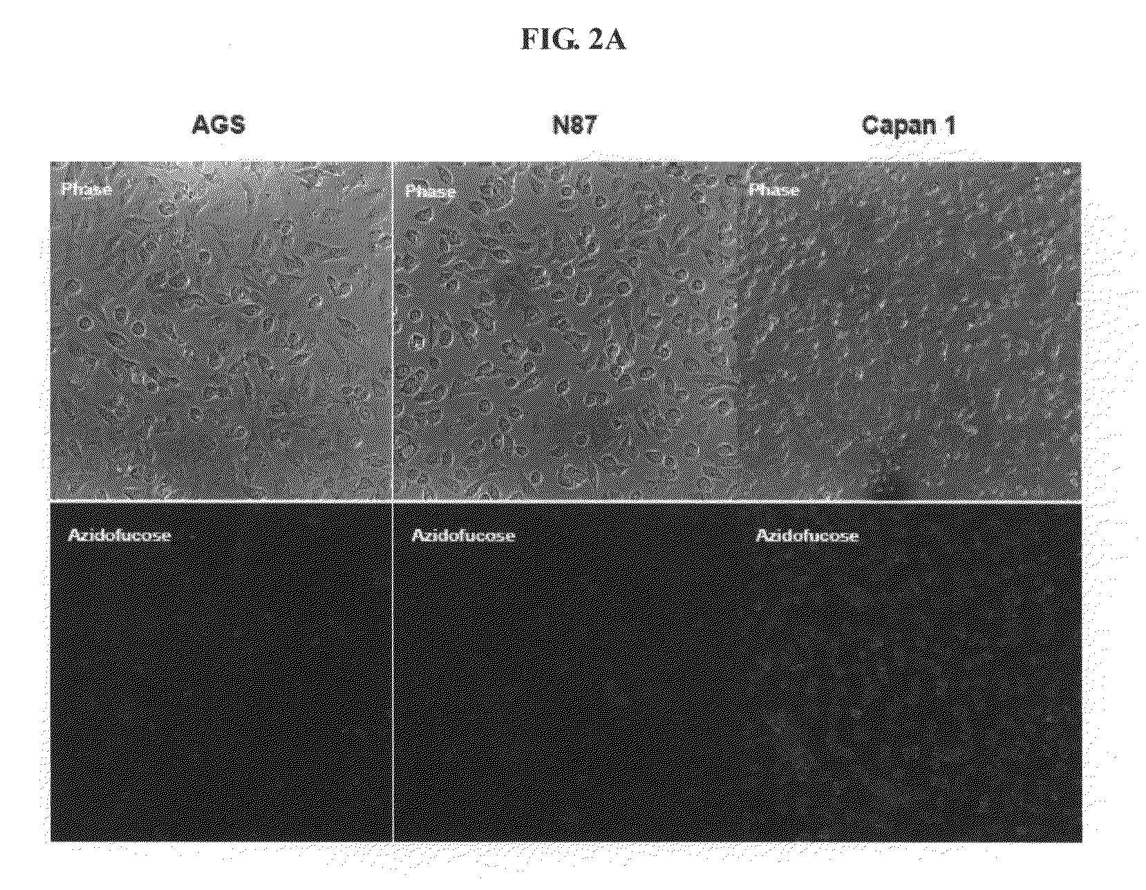 Compositions and assays for treatment and diagnosis of helicobacter pylori infection and conditions