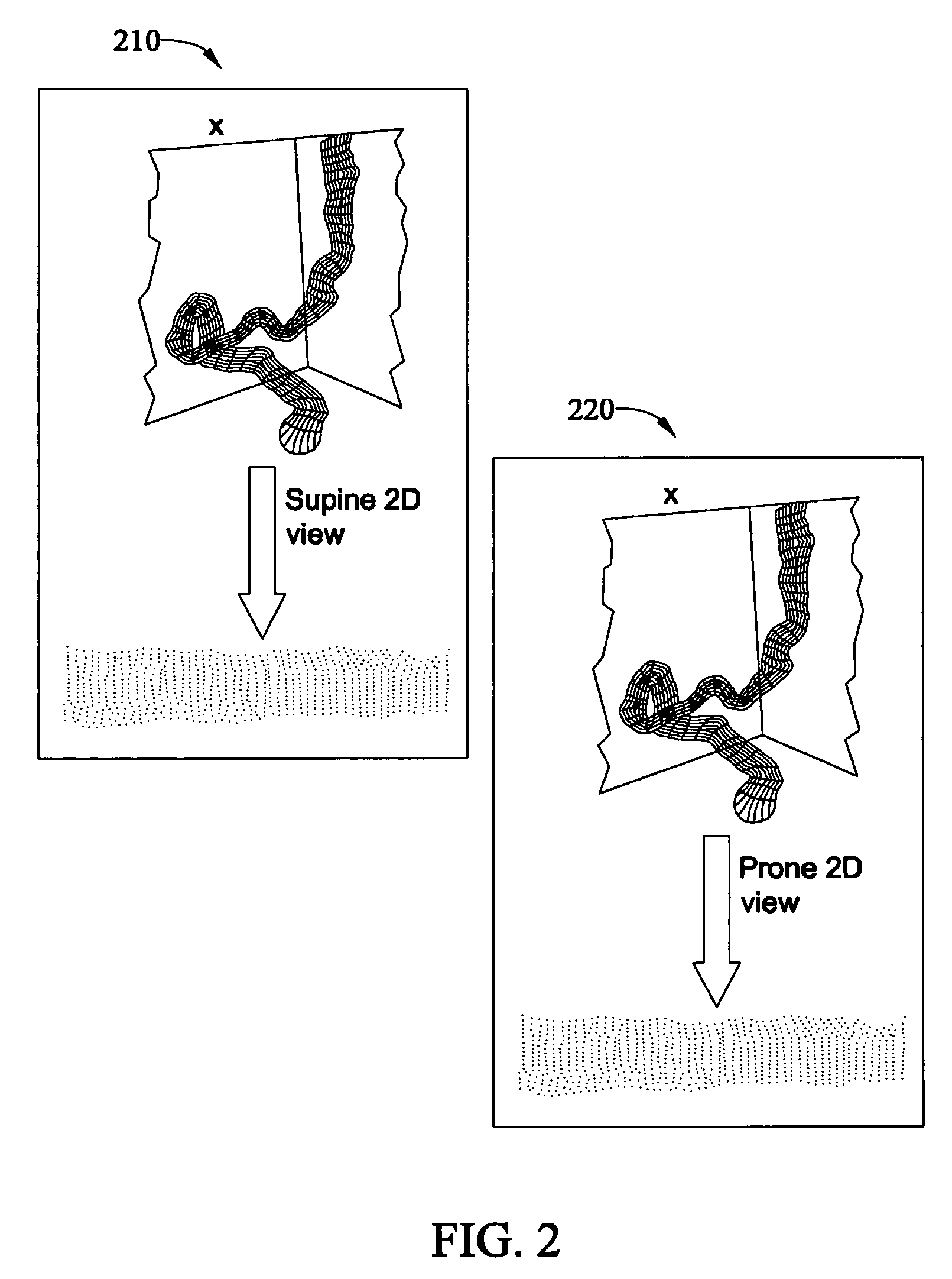 Method and apparatus for synchronizing corresponding landmarks among a plurality of images