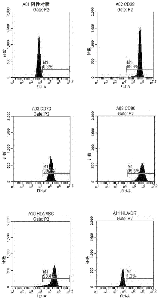 Pancreatic stem cell preparation method and special culture medium composition therefor
