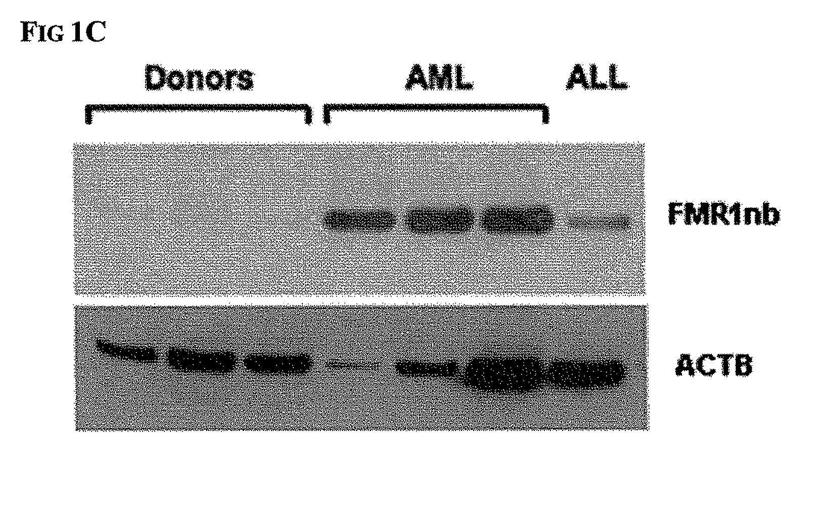 Diagnosis and therapy of hematological malignancies