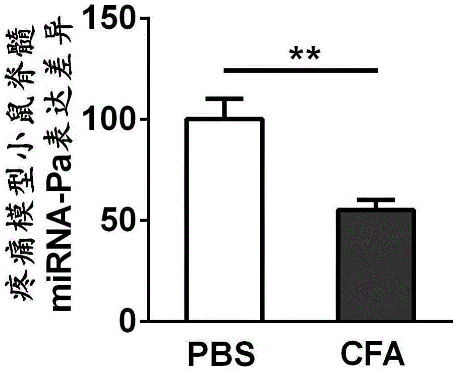 Application of miRNA-Pa compound in preparing chronic pain diagnostic marker and therapy medicine