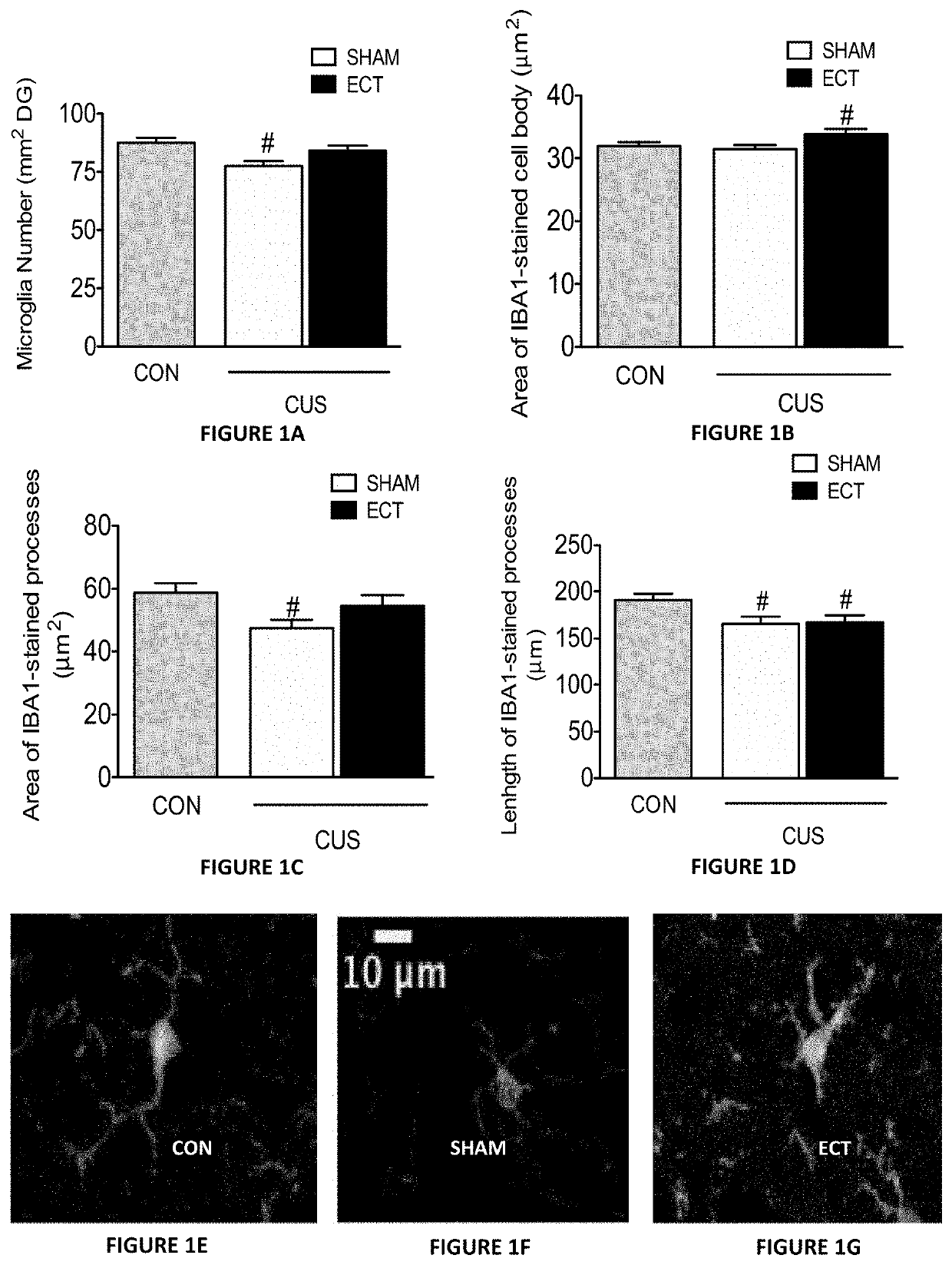 Microglia modulators for use in treatment of depression