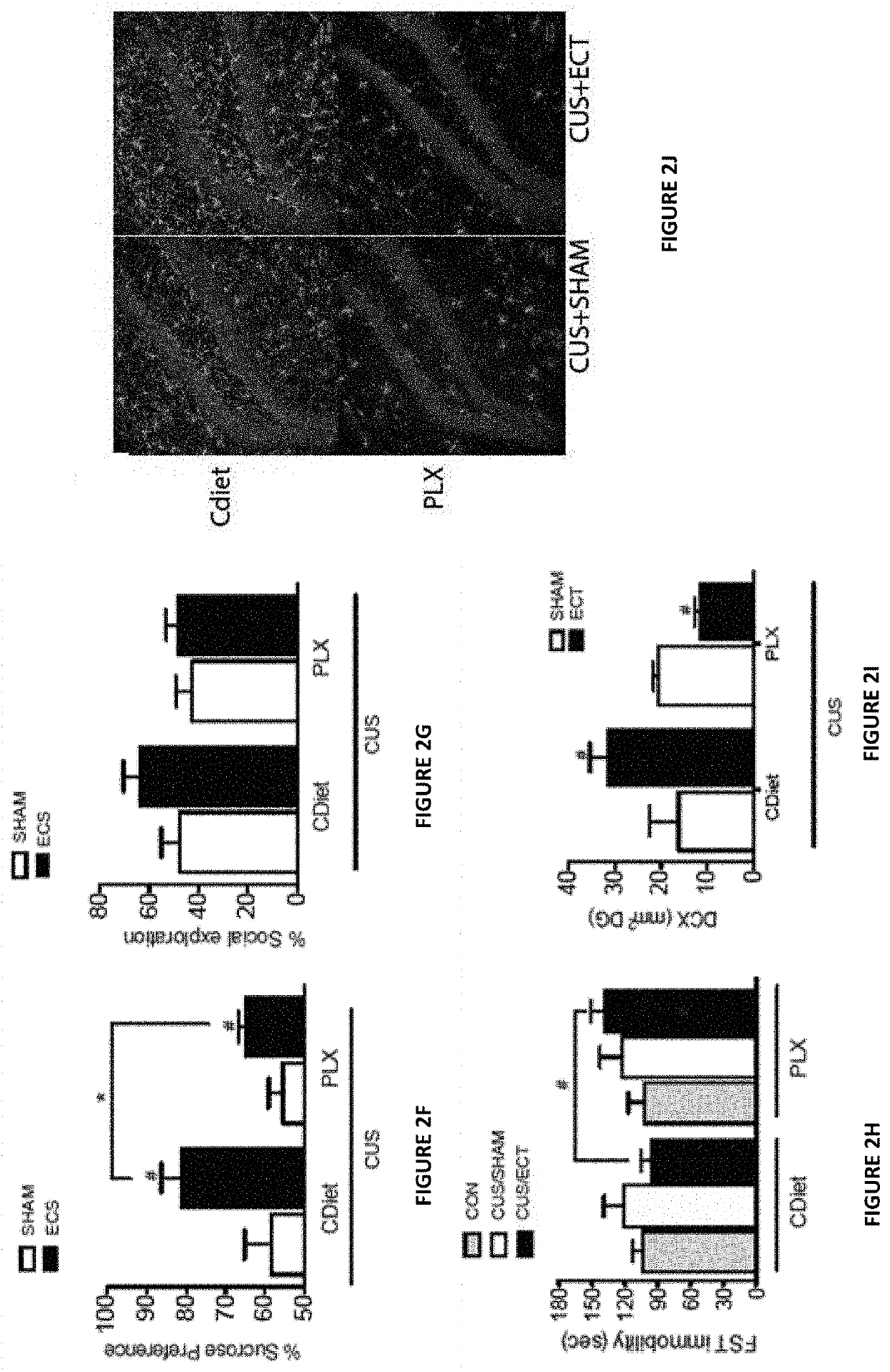 Microglia modulators for use in treatment of depression