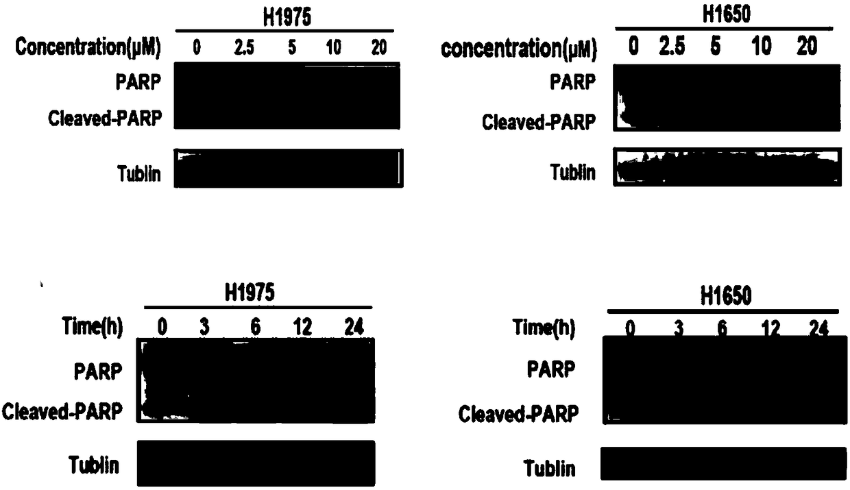 Autophagy inhibitor and afatinib medicine composition and application of composition to preparation of tumor synergist