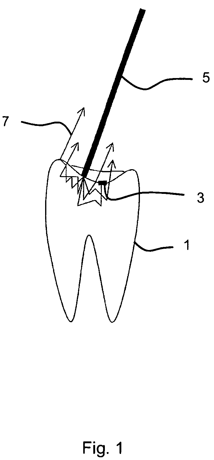 Method for identifying tooth-colored tooth filling residues